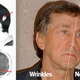 Illustration for article titled Mans half face is forever young after getting hit by particle beam